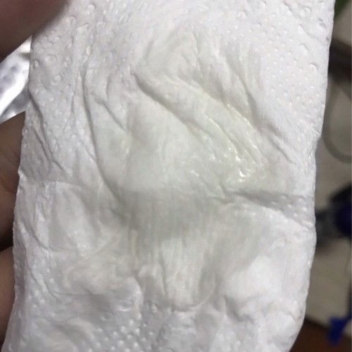 37+4มันคือตกขาวหรือมูกคะ วันนี้รู้สึกจะออกเยอะกว่าปกติ อยากรู้ว่าปกติใช่ไหมคะ😅