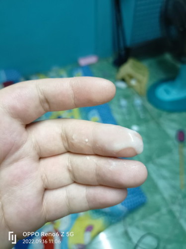 มีน้ำขาวไหลออกมา