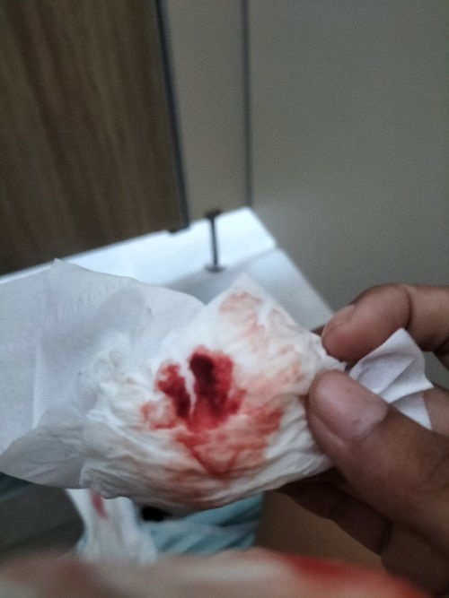 มีเลือดออก