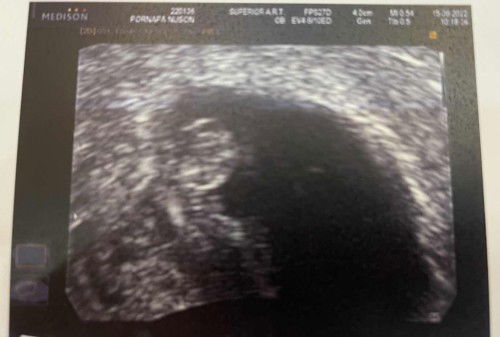 น้อง 8สป. 2วัน