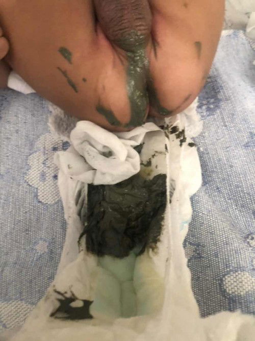 Concern Nan infinipro first baby poop