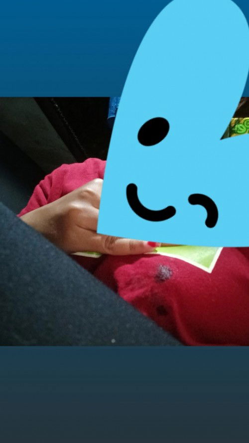 Cairan keluar dipayudara