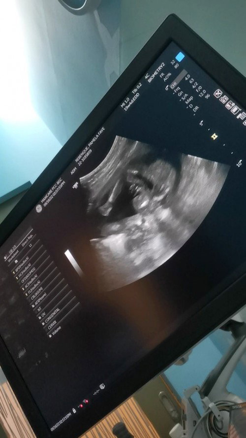 Girl or boy???