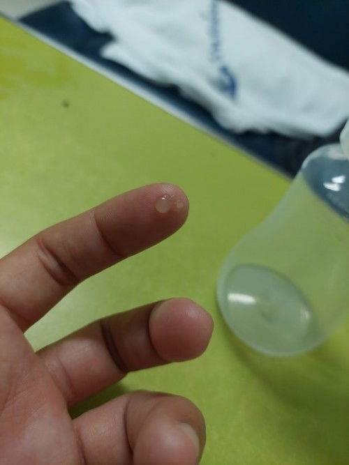 น้องอยู่ตู้อบไม่ได้เข้าเต้า