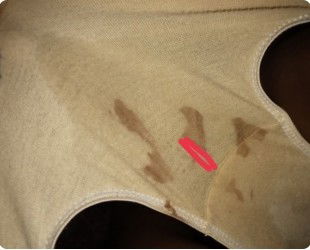 Malapit naba manganak?