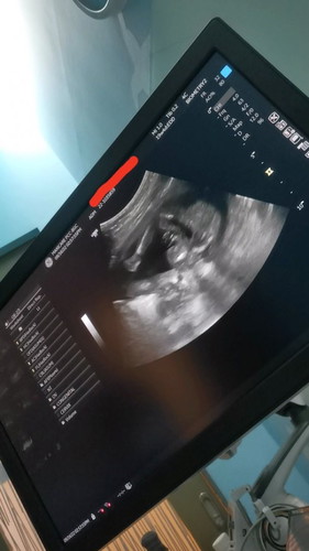Girl or boy?