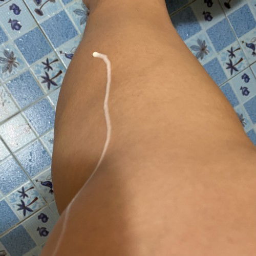 เหน็บยาก่อนนอน พอตื่นเช้ามีน้ำไหลออกมา