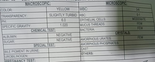 Urinalysis Test Result