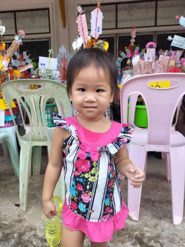 ลูก2ขวบ ชอบทำตาเขเป็นบางครั้ง