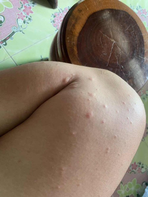 ขออนุญาตสอบถามแม่ๆค่ะ