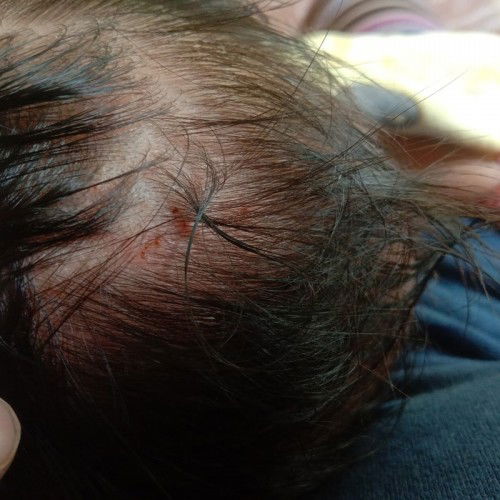 สอบถามแม่ๆค่ะ