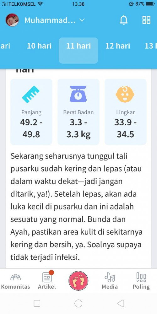 3 hari lahir lepas tali pusar