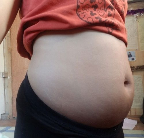 16weeks pregnant po ako d ako nakapag pa OB.