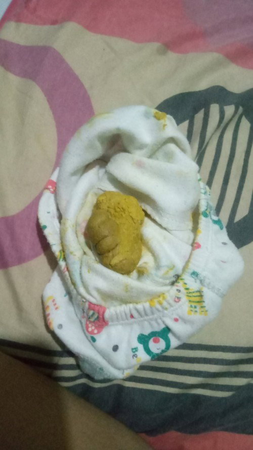 Masalah bab anak