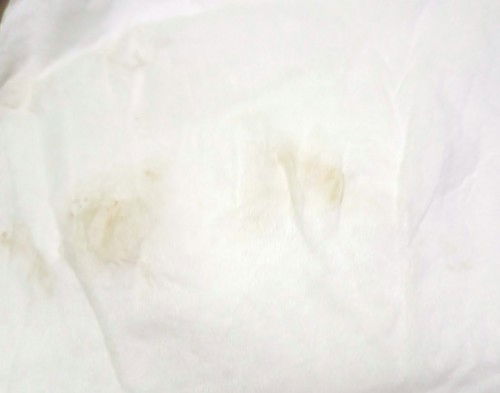 Flek Uk 6 minggu 6 hari