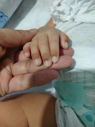 Nangingitim sa paligid ng kuko