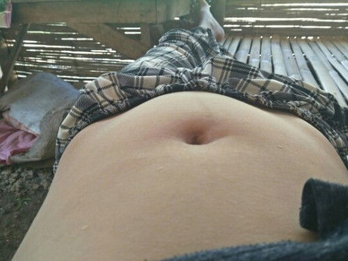 Normal lang ba ganiyan . Tuwing umaga po nauumbok sya..... Puro pitik Lang sino same case ko dito