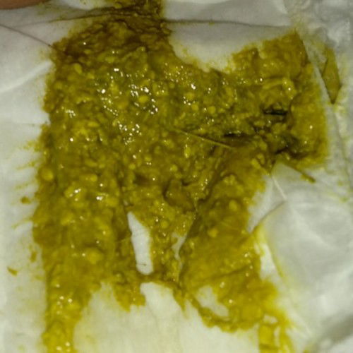 Bayi yang minum susu Neocate