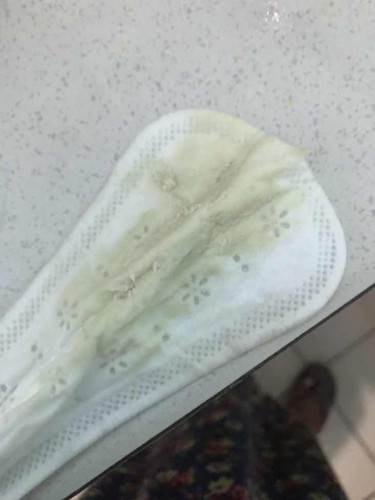 Yeast Infection po ba to