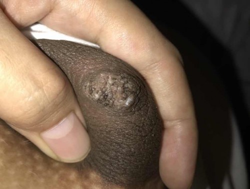 UTONG/NIPPLES