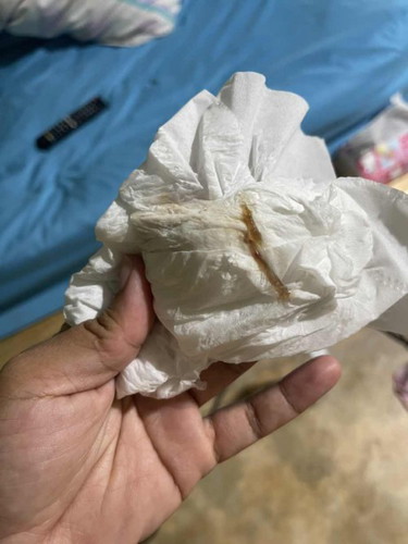 มูกสีน้ำตาลแบบนี้ต้องไปหาหมอมั้ยคะ