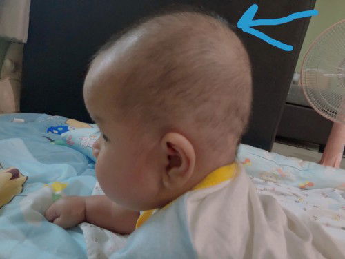 แบบนี้หัวทุยหรือแบนคะ