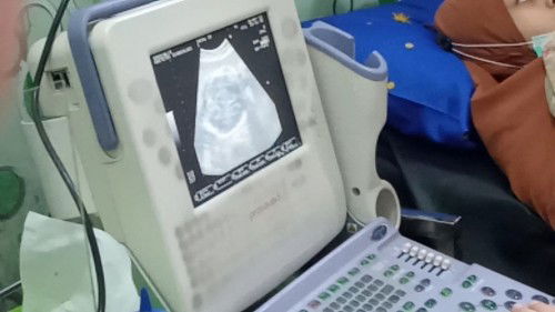 yang hpl November Sini ngumpul