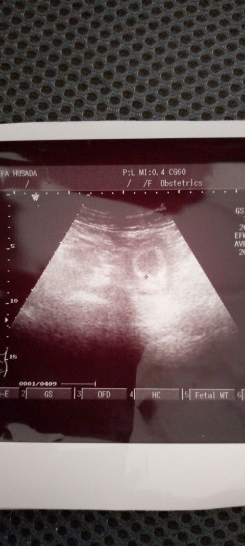 bertanya tentang seputar kehamilan