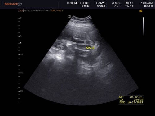 ทีมธันวาคับบ