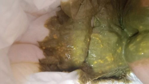 kaler ne normal x? (maaf gmbar kurang mnyenangkan) 😬