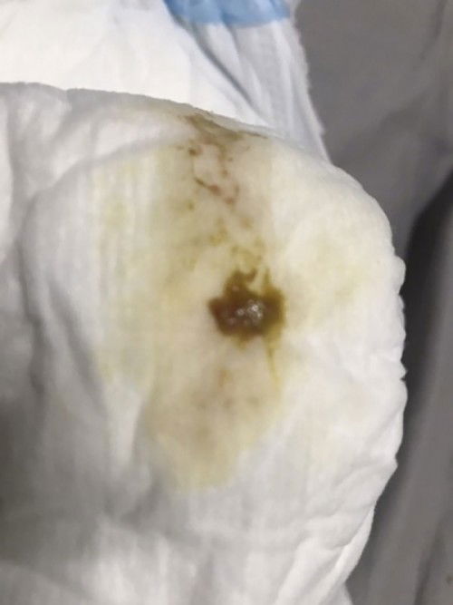 สอบถามแม่ๆหน่อยนะคะ