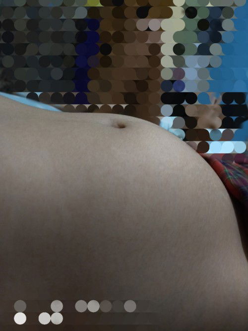 Apa kalau sudah pernah hamil jadi anak selanjutnya perut bakal kecil/atau ddj hanya di bawah pusar??