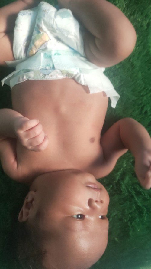 Ada benjolan kecil di atas perut bayi 2 Minggu