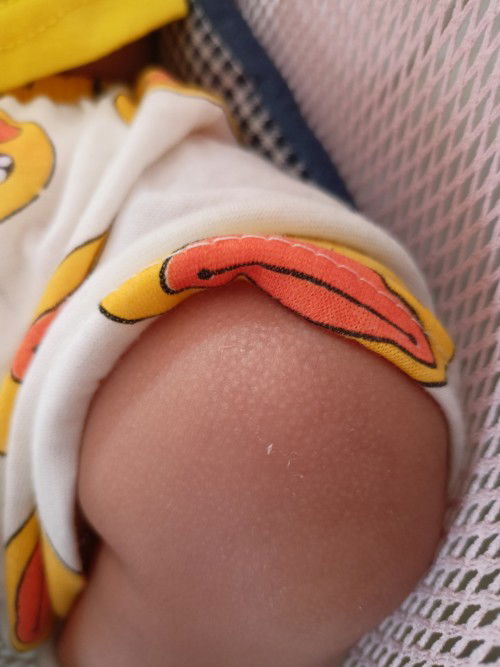 Dengkul anak bintik kasar dan terkadang mengelupas