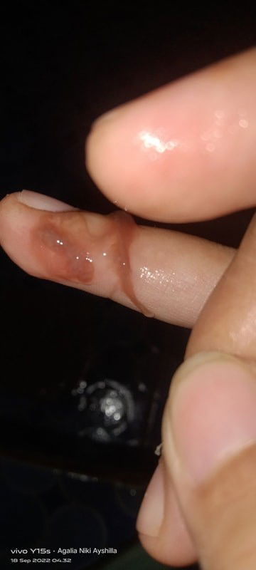 Hamil 37w 6d keluar lendir kecoklatan