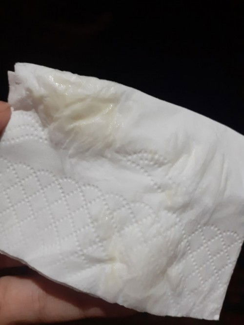 ตกขาวเเบบนี้ควรพบหมอไหมคะ
ตกขาวออกสีเขียวๆเเต่ไม่มีกลิ่นค่ะ