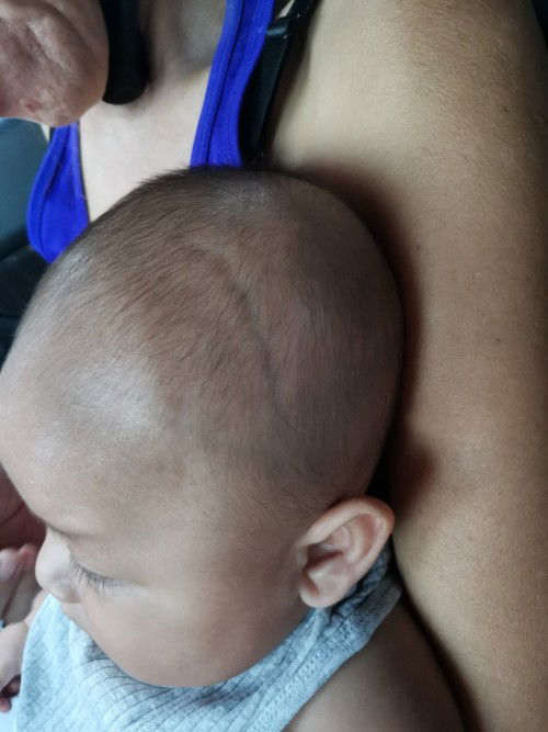 Normal po ba to sa baby?
4 months old po ngayong month baby ko.