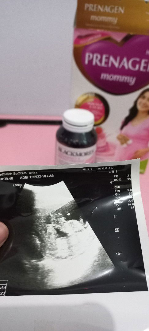 Usg trimester 1