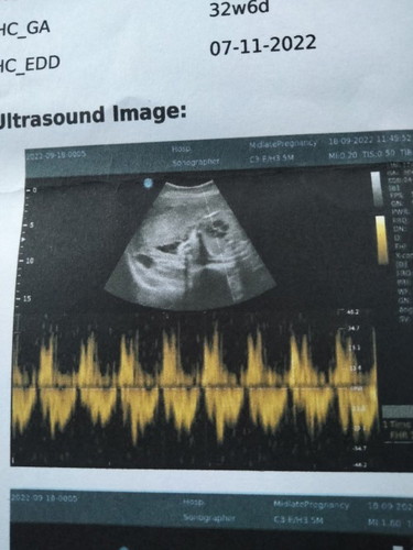 ภาพอัลตร้าชาว