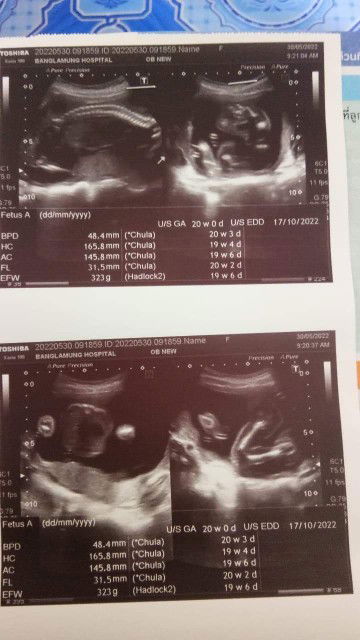 อยากรู้ว่าแบบนี้หญิงหรือชายค่ะ