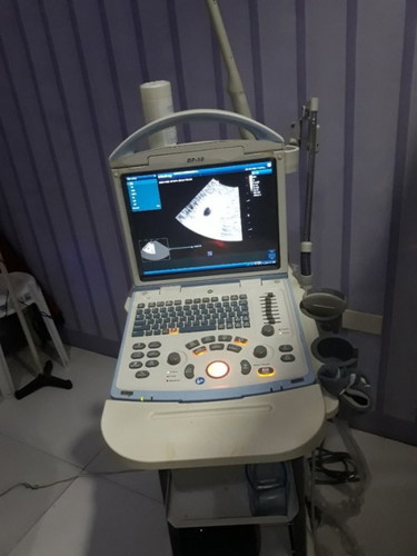makapal po lining matress ko, tapos gestational sac palang nakikita? may naka experience po ba?
