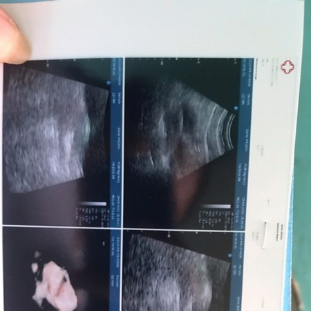 Udah 6 week tapi blm kliatan kantungnya. Gimana yaa mam