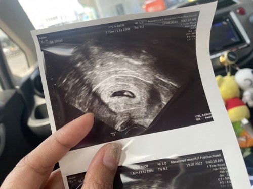 ยุติการตั้งครรภ์