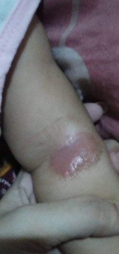 Baka po may nakakaalam Kung ano po ito, at kung ano po pwede igamot😭 stress na stress na po Ako😭