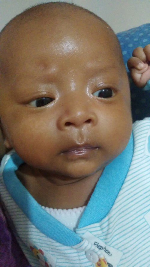 Bercak putih di muka