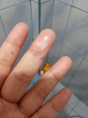 asked lng po normal lng po ba white discharge sa buntis 16weeks po ako ngaun.. pasensya na po sa pic