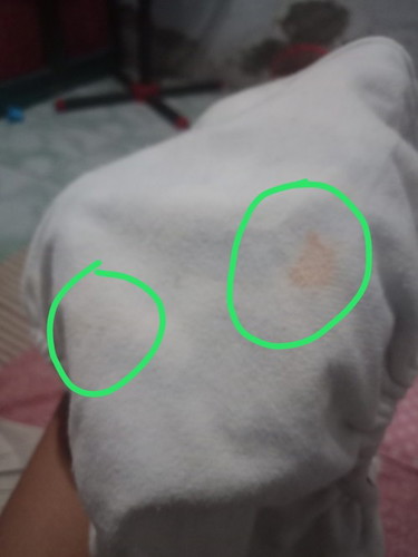 Bund, maaf disini ada gk yang anaknya usia 7+ popoknya kyak ada pink2 gitu , kenapa ya kira2