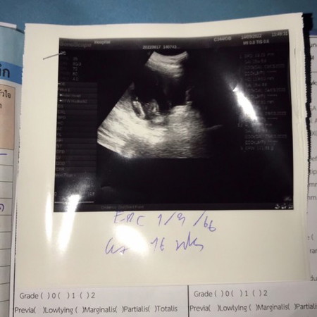 น้องยุตรงไหนคะ