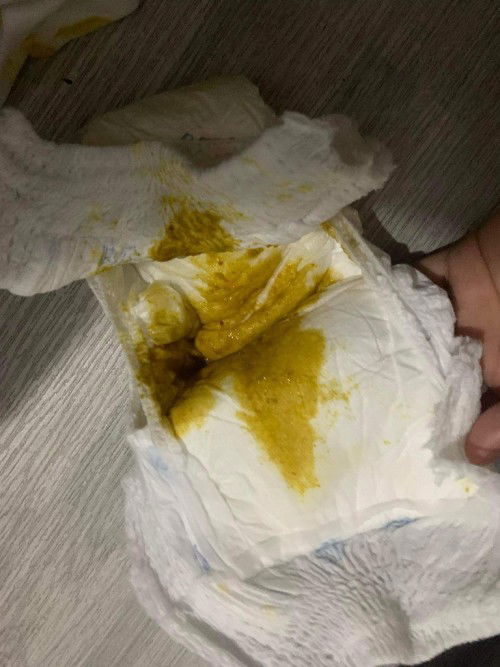 Nagtatae si baby 4month old