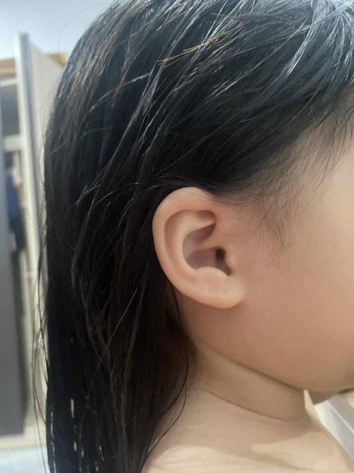 หูพับ เวลาโดนแล้วเจ็บ